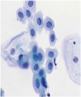 The Cytoplasm Parabasal shaped Homogeneous/Muddy consistency