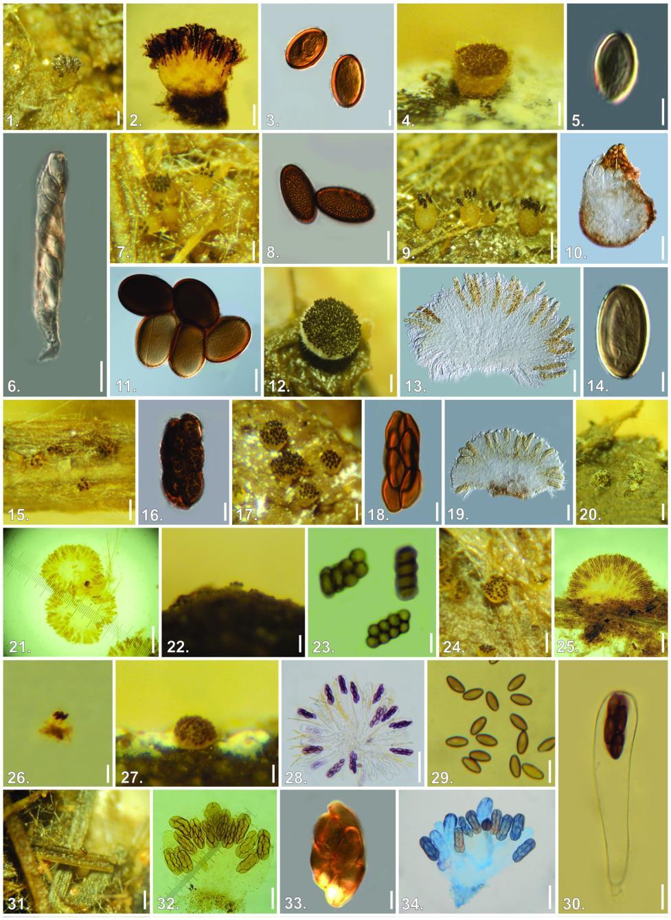 Figures 1 34 Ascobolus americanus. (1) Apothecium on dung (Bar = 200 µm), (2) mounted apothecium (Bar = 100 µm) and (3) mature spores (Bar = 10 µm). A. crenulatus.