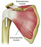 During the procedure, your surgeon will also insert surgical instruments through other small incisions in the shoulder to first perform a bursectomy (removal of the inflamed bursal sac) and an
