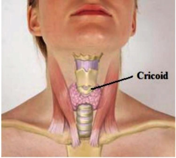 below Cricoid cartilage, medial to