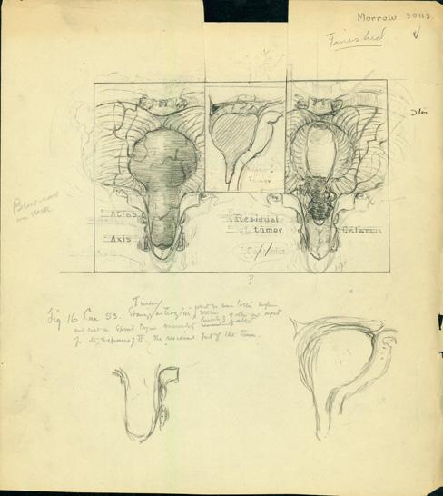 Two of the drawings signed by Codding. One illustration, labeled Fig. 12, present in both draft and finished state. Very good. See illustration on page 10.
