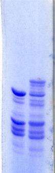 Label Free Quantification Extracted Ion Chromatogram Based Methods In-Vitro Phosphorylation of BZR1 by BIN2 Kinase E.