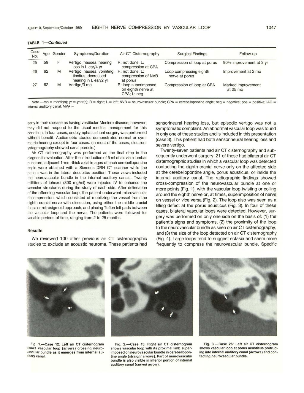AJNR :1 0, September/October 1989 EIGHTH NERVE COMPRESSION BY VASCULAR LOOP 1047 TABLE 1- Continued Case No.