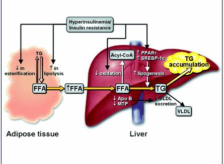 NAFLD and