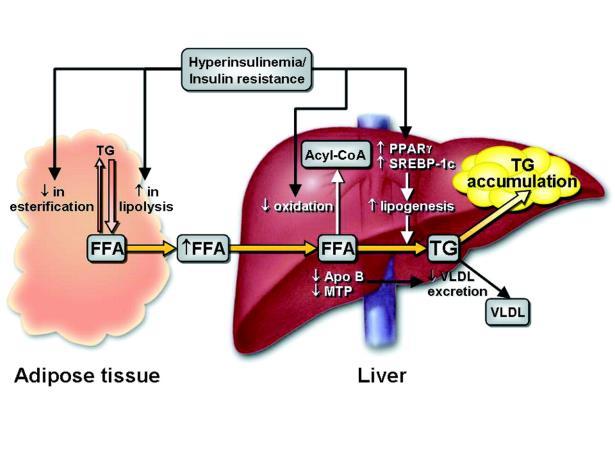 Prevalence 19 Pathophysiology The cause of the stored fat resulting in inflammation (NASH) has not yet been fully elucidated, but likely results in a metabolic second hit. Source: Schuppan, D.