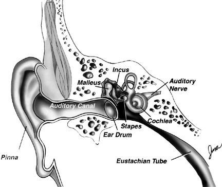 Diagnosis Ear Picture Otosclerosis Disease of abnormal bone remodeling within the middle/inner ear Most patients present with unilateral conductive hearing loss and normal TM examination More severe