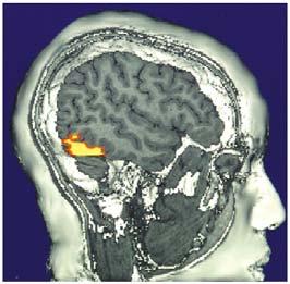 The Cerebral Cortex Functional MRI scan