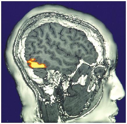 The Cerebral Cortex Functional MRI scan shows the