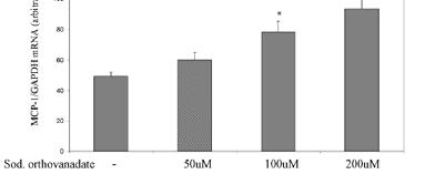 mrna (arbitrary unit ts) RINm5F cells 1 hr 3 hr genistein mol/l