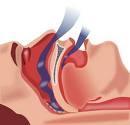 breathing during sleep Tissues in the back of the