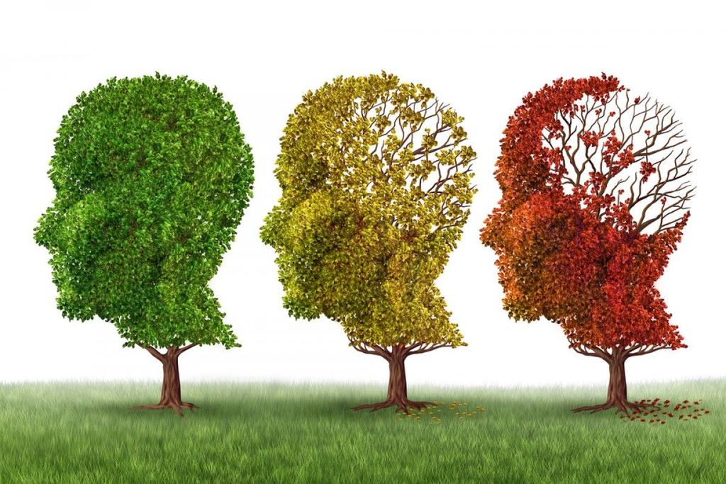 Alzheimer s disease - an overview CLINICAL FEATURES Neurodegenerative disorder Most common type of dementia (60%), generally