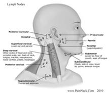 Oropharyngeal cancer Typically cancer of the tonsils or base of tongue Squamous cell