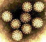 Human Papillomavirus Infection and Anogenital Disease High-risk HPV DNA is present in 99.