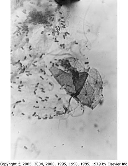 Figure 66-3 Light-microscopic specimen of urine showing uromucoid