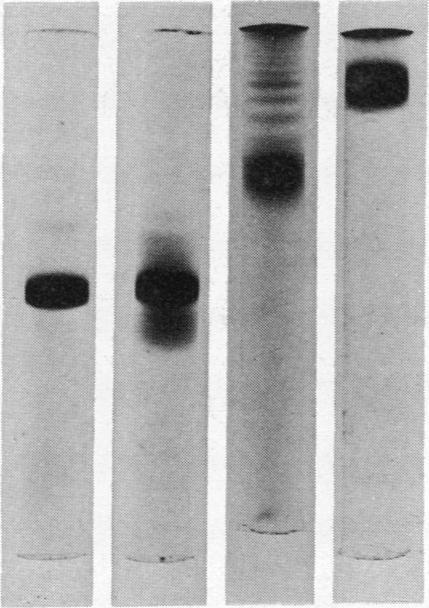 The results indicate that a 200-fold purification of the zinc protein (Table 1) was accomplished by the three chromatographic procedures.