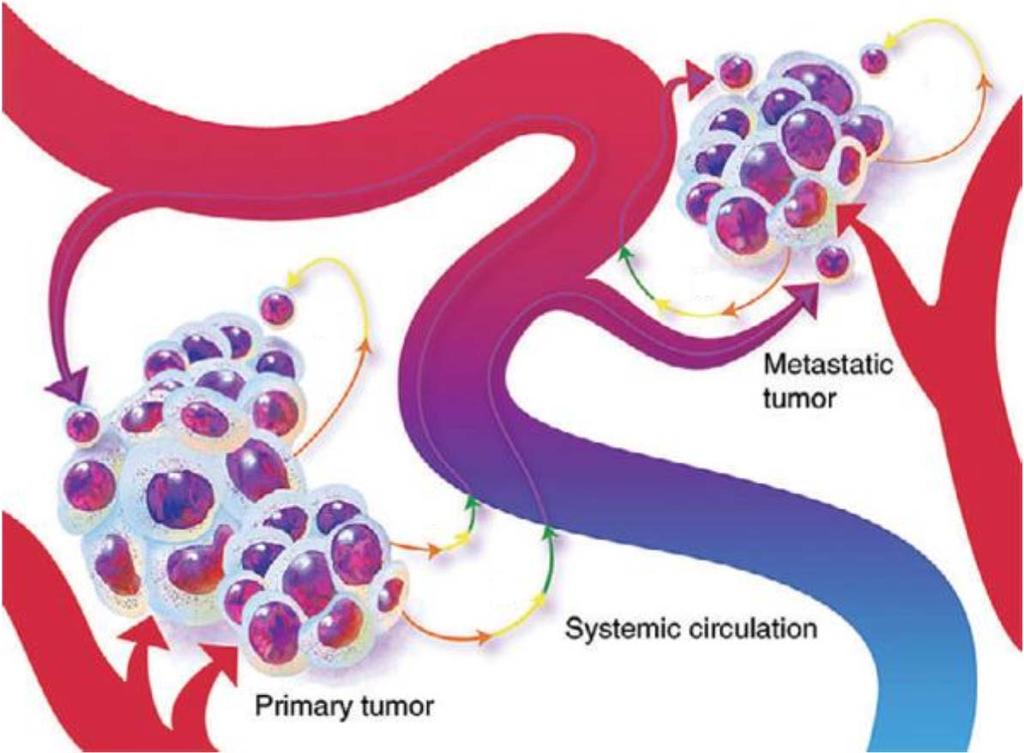 Metastatic Process Metastatic process Disseminated tumor cells Bone as the
