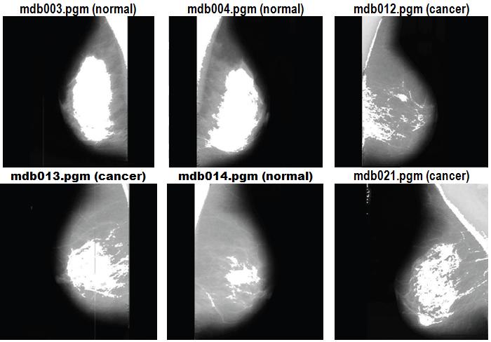 1-02 Performance Evaluation Of Curvilinear Structure Removal Methods In Mammogram Image Analysis Table 1. Experimental Result MIAS Ref. No. mdb001.pgm mdb002.pgm mdb003.pgm mdb004.pgm mdb005.