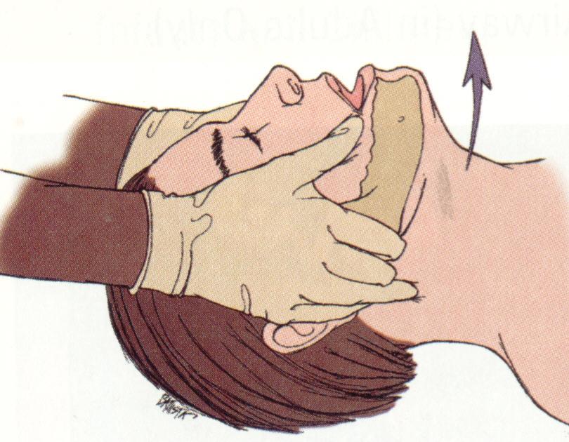 Airway Management Opening the Airway Basic airway management begins with opening and maintaining the airway. The main goal is to prevent the tongue from blocking the airway.