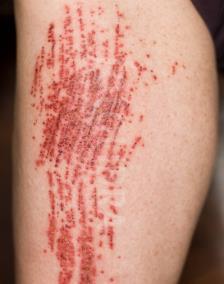 Identify the type of injuries and match the injuries to the priority of treatment.