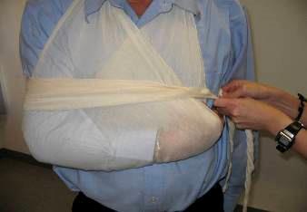 for upper arm fracture cases: The injured area should be