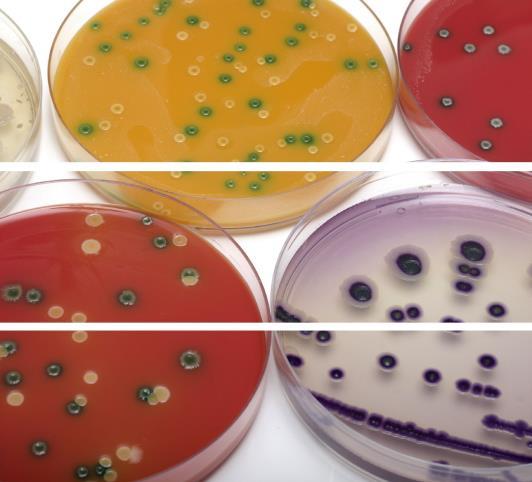 ORGANISMS COMMONLY CAUSING SSIs Staphylococcus aureus Coagulase-negative staphylococci Gram negative bacilli Anaerobes group B streptococci It is important that you understand what the microbiology