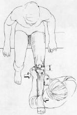 Varus Stress Test Box 6-10, p. 216 Stabilize the jointline and ADD distal leg 2 positions: Full ext.