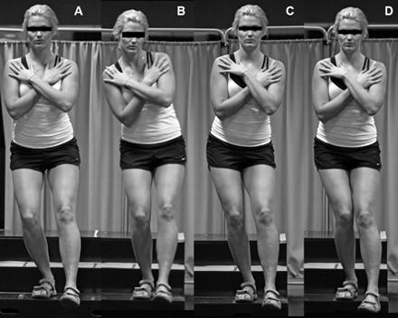 Testing Functional Hip Crossley AJSM 2011 A- participant demonstrates good performance B- participant demonstrates poor overall and trunk