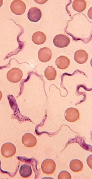 Sleeping sickness caused by Trypanosoma brucei extracellular parasite, 20 µm length long