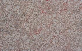 (picrosirius red staining) and greater steatosis (oil red O Staining)