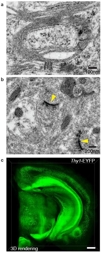 RESEARCH SUPPLEMENTARY INFORMATION Supplementary Figure 4. Electron microscopic imaging of clarified mouse brain tissue: potential EM-compatibility of CLARITY.
