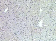 8 week-old mice with hepatic deletion of HMGB1 (Hmgb1 Δhep, n=9) showed reduction of cytokeratin-positive ductular cells (A), lower