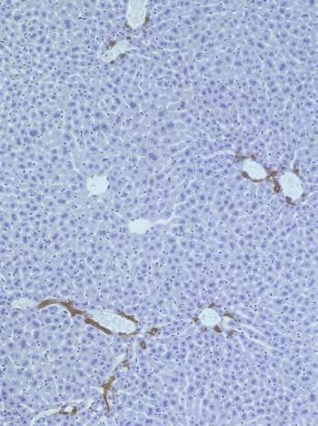 Following three weeks of DDC diet, Hmgb1 Δhep mice (n=9) showed reduction of cytokeratin-positive ductular cells (E), lower