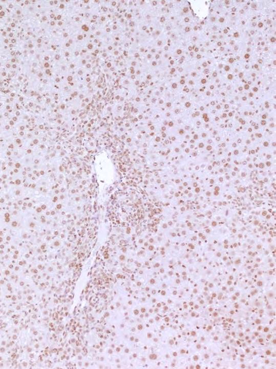 1 2 week-old ctls Hmgb1 fl/fl Mdr2 KO mice were infected with AAV8-TBG-Cre (i.v.
