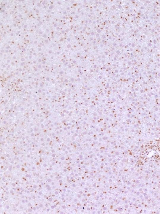 Immunohistochemical HMGB1 staining was performed, demonstrating efficient deletion of HMGB1 from hepatocytes in
