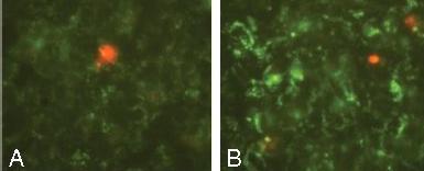 6. Data Analysis A. Cell Staining Figure 1. Chloroquine increases lysosome accumulation but not cell death in HepG2 cells as measured by fluorescent microscopy.