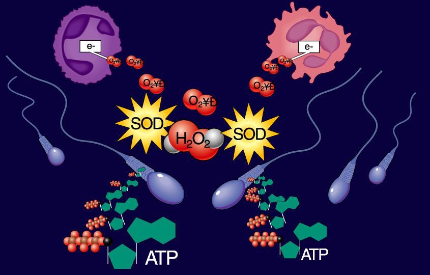Oxidative Stress What is it : When oxidants outnumber antioxidants Reactive oxygen species (ROS) Generated by seminal leukocytes and sperm React with lipids, proteins and nucleic acids Neutrophils