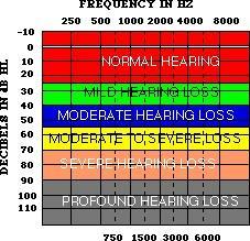 Degrees of Hearing Loss Normal 10-25 db Mild 30-45