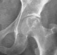 bones, extending to articular cartilage