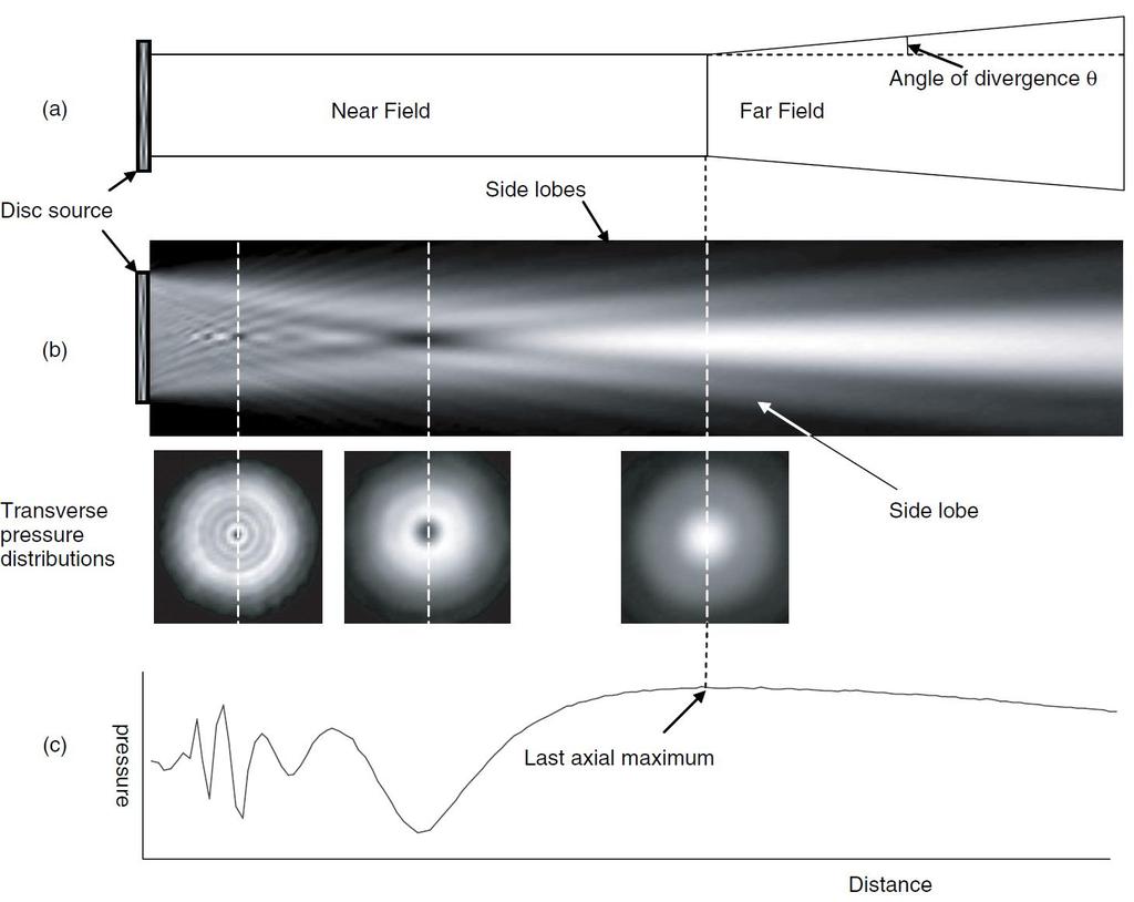 Ultrasound Physics Interference and