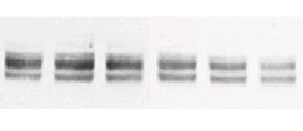 A B Control AdGSK3βS9A GLUT1 [ GLUT1 Expression (Relative Units) 8000 4000 0 Control * AdGSK3βS9A H 3 2-deoxy-glucose Uptake (nmol/mg protein/min) 0.15 0.10 0.05 0.