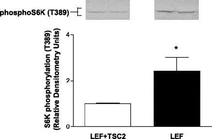Figure 6. Loss of functional TSC2 leads to increased S6K phosphorylation.