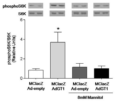 Figure 3. Increased S6K phosphorylation resulting from GLUT1 overexpression was glucose dependent.