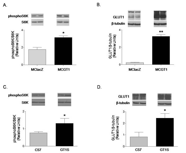 Figure 5. Long-term GLUT1 overexpression results in increased S6K phosphorylation. Chronic GLUT1 overexpression increased S6K (Thr389) phosphorylation in rat mesangial cells (A. n=4, * p<0.