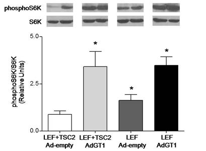 Figure 6. TSC2 is not required for increased S6K phosphorylation by GLUT1 overexpression.
