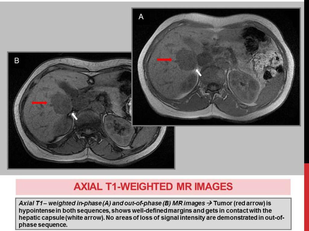 Fig. 7: AXIAL