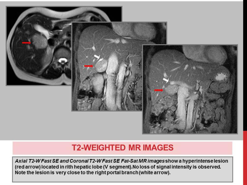 Fig. 8: T2-WEIGHTED
