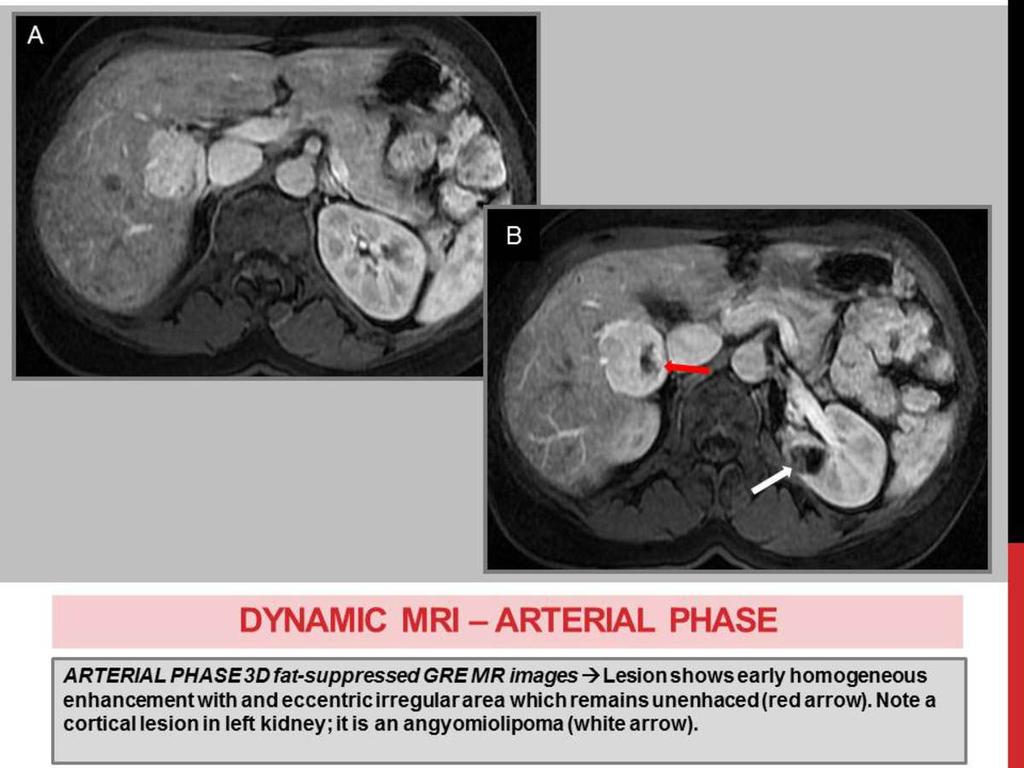 Fig. 9: DYNAMIC MRI -