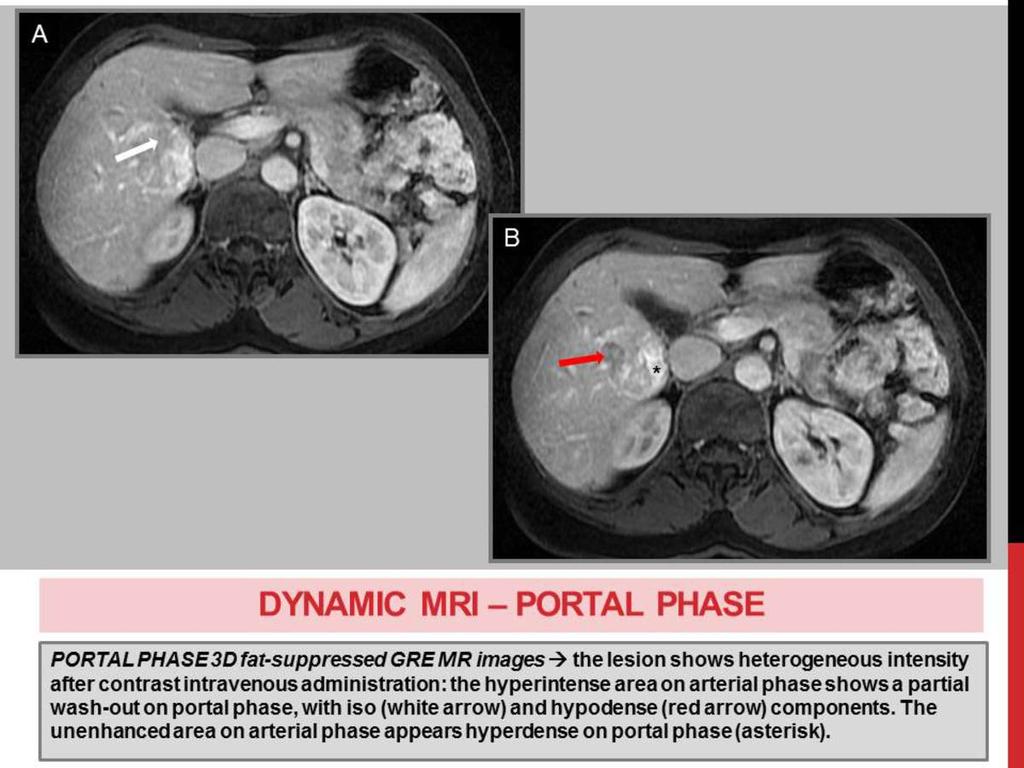 Fig. 10: DYNAMIC MRI -