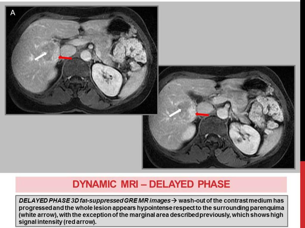 Fig. 11: DYNAMIC MRI -