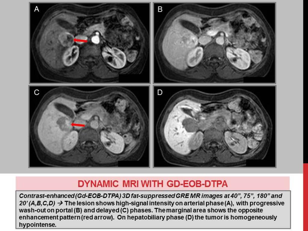 Fig. 13: DYNAMIC MRI WITH